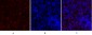 PKM2 Polyclonal Antibody